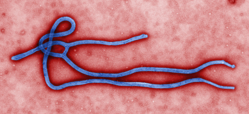 The Ebola Virus (Image: CDC)